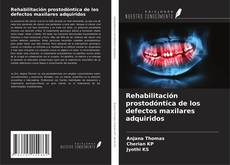 Copertina di Rehabilitación prostodóntica de los defectos maxilares adquiridos