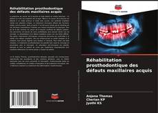 Обложка Réhabilitation prosthodontique des défauts maxillaires acquis