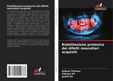 Buchcover von Riabilitazione protesica dei difetti mascellari acquisiti