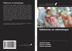 Buchcover von Adhesivos en odontología