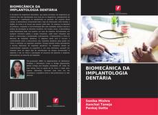 BIOMECÂNICA DA IMPLANTOLOGIA DENTÁRIA的封面