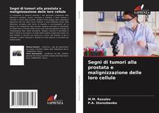 Buchcover von Segni di tumori alla prostata e malignizzazione delle loro cellule