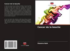 Bookcover of Cancer de la bouche