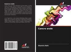Обложка Cancro orale
