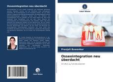 Bookcover of Osseointegration neu überdacht