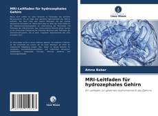 Buchcover von MRI-Leitfaden für hydrozephales Gehirn