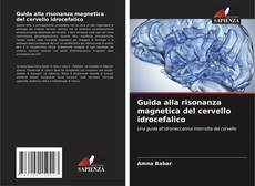 Buchcover von Guida alla risonanza magnetica del cervello idrocefalico