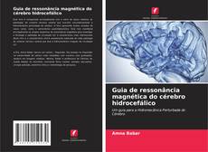 Bookcover of Guia de ressonância magnética do cérebro hidrocefálico