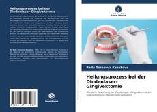 Buchcover von Heilungsprozess bei der Diodenlaser-Gingivektomie
