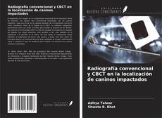 Buchcover von Radiografía convencional y CBCT en la localización de caninos impactados