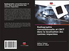 Borítókép a  Radiographie conventionnelle et CBCT dans la localisation des canines impactées - hoz