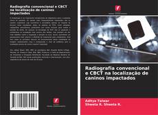 Buchcover von Radiografia convencional e CBCT na localização de caninos impactados