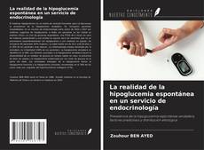 Buchcover von La realidad de la hipoglucemia espontánea en un servicio de endocrinología