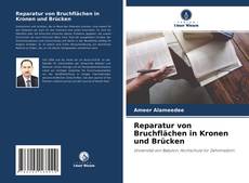 Buchcover von Reparatur von Bruchflächen in Kronen und Brücken