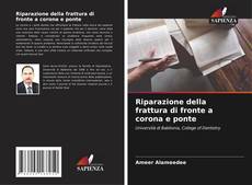 Capa do livro de Riparazione della frattura di fronte a corona e ponte 