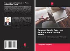 Couverture de Reparação de Fractura de Face em Coroa e Ponte
