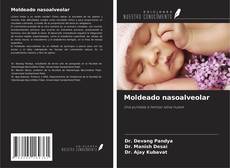 Couverture de Moldeado nasoalveolar