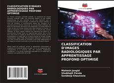 CLASSIFICATION D'IMAGES RADIOLOGIQUES PAR APPRENTISSAGE PROFOND OPTIMISÉ kitap kapağı