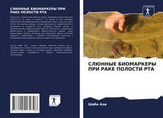 Capa do livro de СЛЮННЫЕ БИОМАРКЕРЫ ПРИ РАКЕ ПОЛОСТИ РТА 