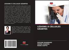 Buchcover von LÉSIONS À CELLULES GÉANTES