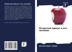 Capa do livro de Открытый прикус и его лечение 