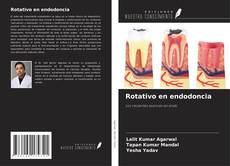 Buchcover von Rotativo en endodoncia