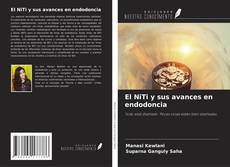 Capa do livro de El NiTi y sus avances en endodoncia 