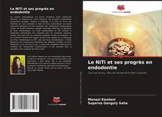 Buchcover von Le NiTi et ses progrès en endodontie