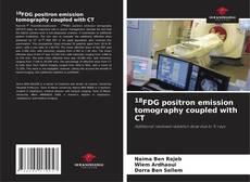Capa do livro de 18FDG positron emission tomography coupled with CT 