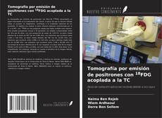 Capa do livro de Tomografía por emisión de positrones con 18FDG acoplada a la TC 