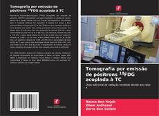 Buchcover von Tomografia por emissão de pósitrons 18FDG acoplada à TC