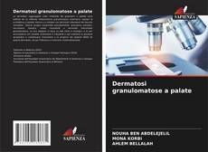 Buchcover von Dermatosi granulomatose a palate