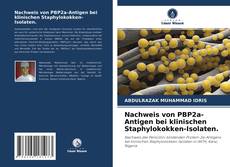 Couverture de Nachweis von PBP2a-Antigen bei klinischen Staphylokokken-Isolaten.