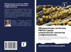 Couverture de Обнаружение антигена PBP2a среди клинических изолятов стафилококков.