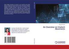 Copertina di An Overview on Implant Abutments
