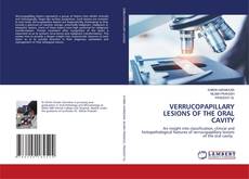 Copertina di VERRUCOPAPILLARY LESIONS OF THE ORAL CAVITY