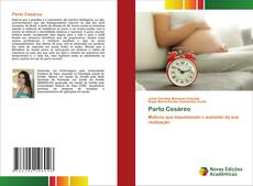 Copertina di Parto Cesáreo