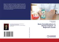 Copertina di Basic Considerations in Dental implant - A Beginners Guide