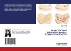 Bookcover of FABRICATION OF REMOVABLE PARTIAL DENTURE FRAMEWORK