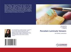 Bookcover of Porcelain Laminate Veneers