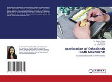 Copertina di Acceleration of Othodontic Tooth Movements