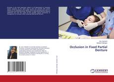 Copertina di Occlusion in Fixed Partial Denture