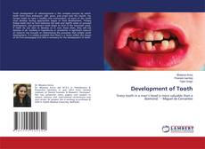 Copertina di Development of Tooth