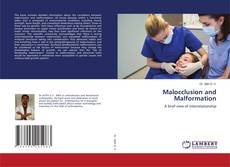 Copertina di Malocclusion and Malformation
