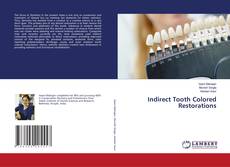 Copertina di Indirect Tooth Colored Restorations