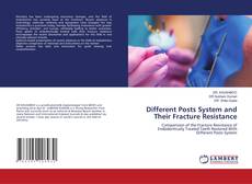 Copertina di Different Posts System and Their Fracture Resistance