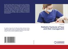 Buchcover von Pediatric fractures of face and their management