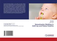 Buchcover von Nasoalveolar Molding in Cleft Lip and Palate Patients