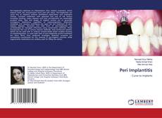 Buchcover von Peri Implantitis