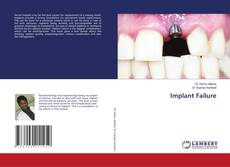 Copertina di Implant Failure